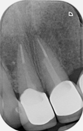 12-month review demonstrating healing case